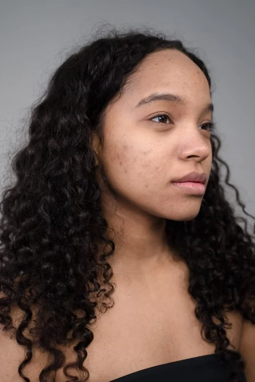 Dark Spot Removal
