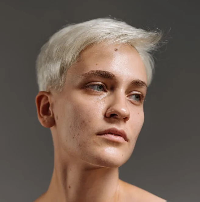 Large Pores & Texture Issues