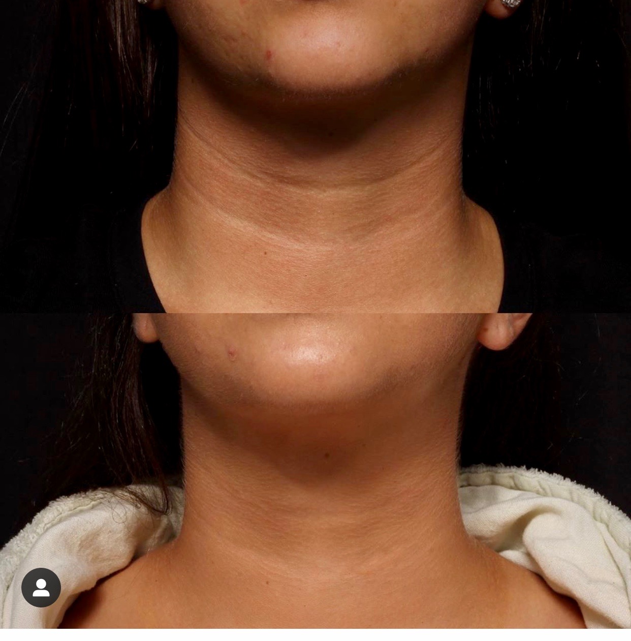 NECK LINES