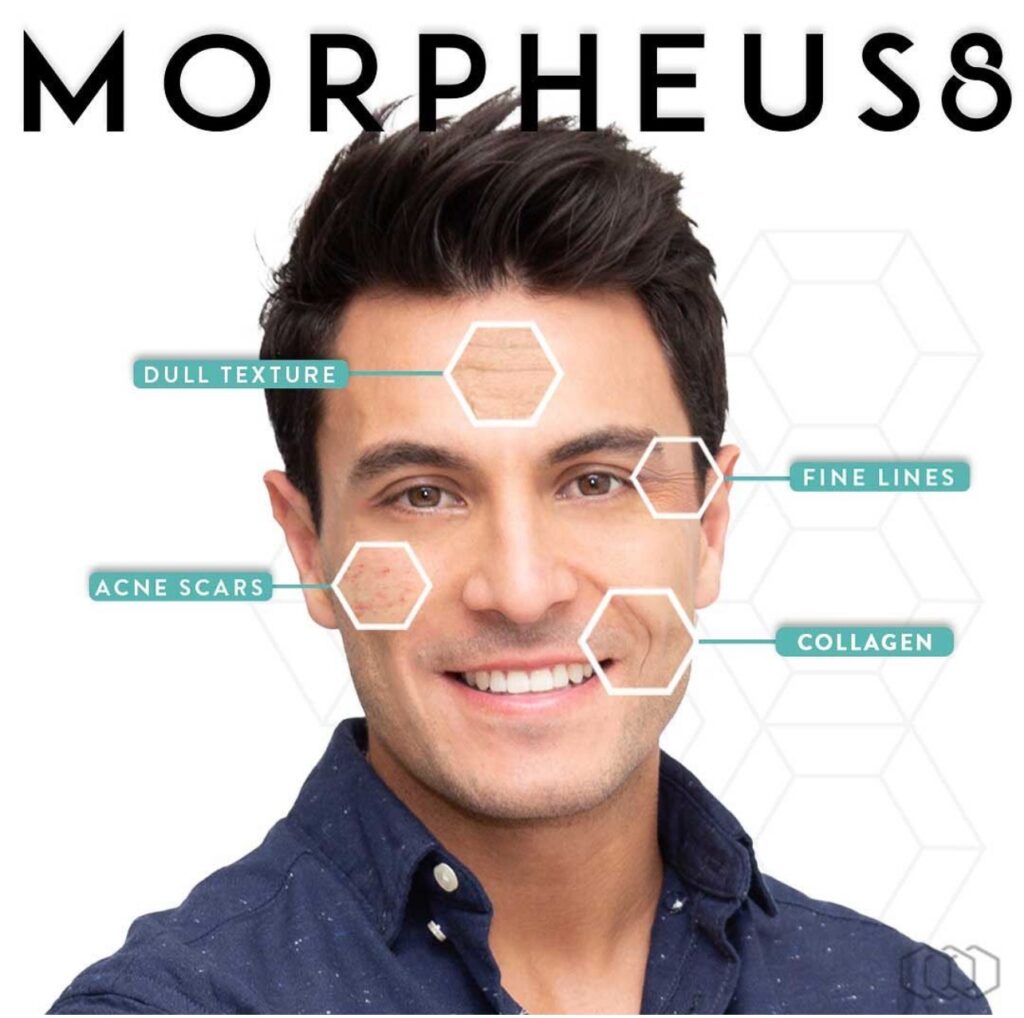 Morpheus8