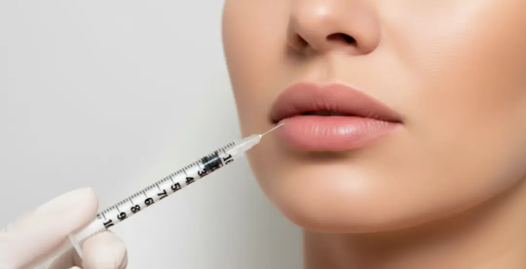How Many Syringes for Lip Fillers? What You Should Know